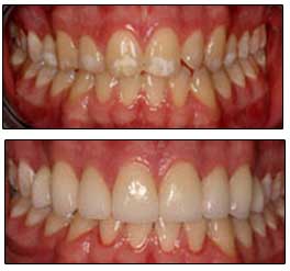 Lawndale Cosmetic Dentist